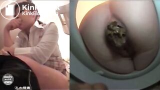 Giant poop and diarrhea