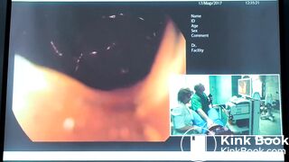 Веселов ВВ Трудная Колоноскопия