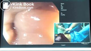 Веселов ВВ Трудная Колоноскопия