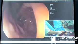 Веселов ВВ Трудная Колоноскопия