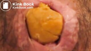 Anus When Defecating (Compilation)