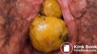 Anus When Defecating (Compilation)