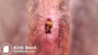 Anus When Defecating (Compilation)