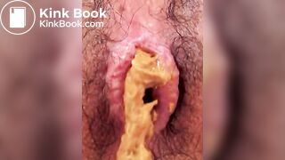 Anus When Defecating (Compilation)