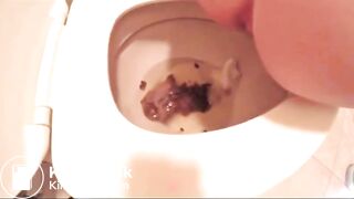 Show Me How You Poop