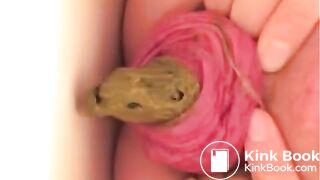 Prolapse and shit, my two favourites