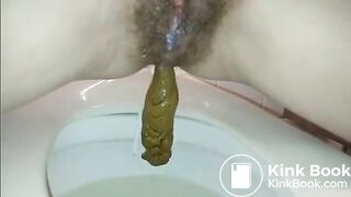 Hairy poop and pee