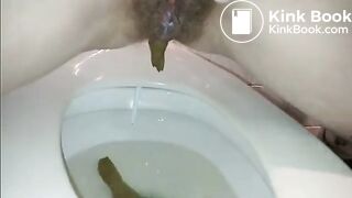Hairy poop and pee