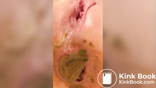 Close-up In The Ass Dildo And Shit