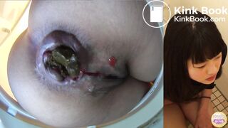 Constipated japanese baby