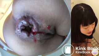 Constipated japanese baby