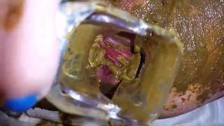 Speculum full of poop - part 3