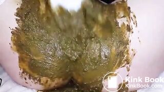 Speculum full of poop - part 3