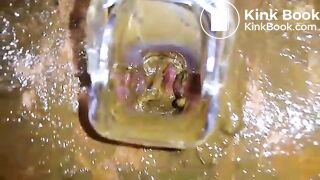 Speculum full of poop - part 3