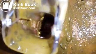 Speculum full of poop - part 3