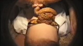 fazendo monte de merda na cara da enfermeira