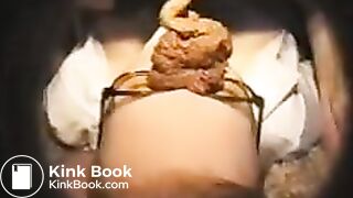 fazendo monte de merda na cara da enfermeira