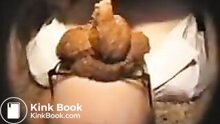 fazendo monte de merda na cara da enfermeira