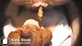 fazendo monte de merda na cara da enfermeira