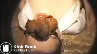 fazendo monte de merda na cara da enfermeira