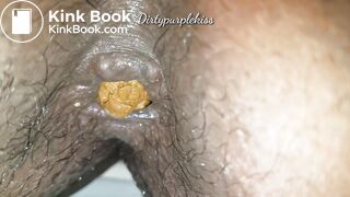 Constipation with soft finish