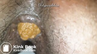 Constipation with soft finish