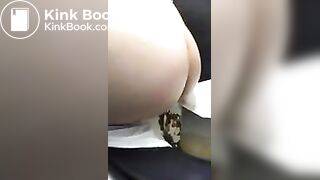 Laxative diarrhea - video 2