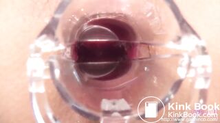 Girl Shitting and Pissing