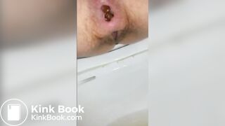 (F) Her Daily Poop Video Diary #1