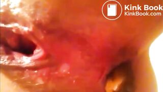 teen shitting close up