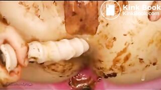 Jap babe shows her anal prolapse