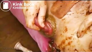 Jap babe shows her anal prolapse