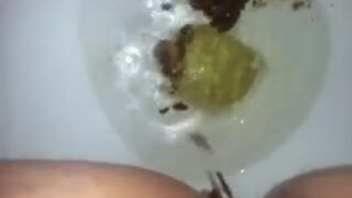 runny shit between legs 3
