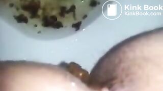 runny shit between legs 3
