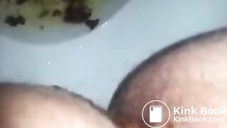 runny shit between legs 3