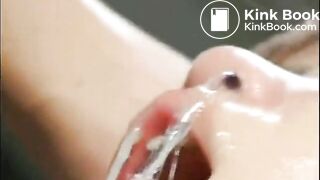 Vomit and enema treatment - part 6