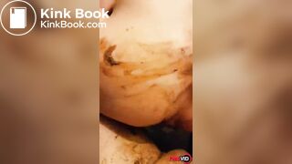 nice view of shitty ass