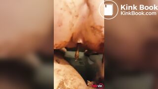 nice view of shitty ass