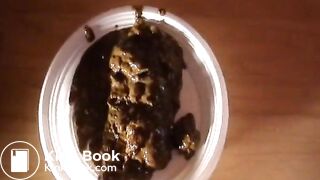 Big Amount of Diarrhea