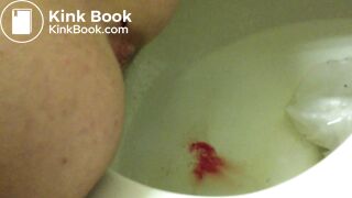 21 Year Old Mary Shitting 2