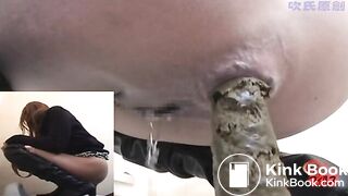 It's amazing to see a little girl hold in that much poop, for at least 2 or 3 days