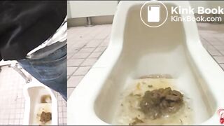 Hairy hole and a huge pile