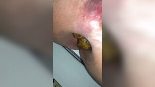 Close up pooping - video 2