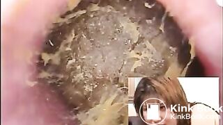 Exodus Gold 08 - DWS-08