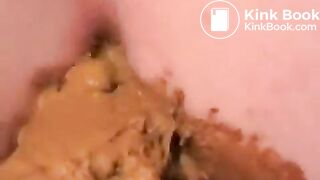 Girl puts dildo in pooping ass