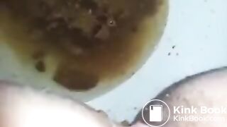 runny shit between legs 2