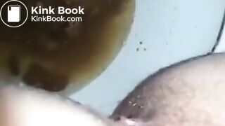 runny shit between legs 2