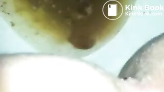 runny shit between legs 2