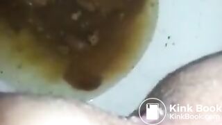 runny shit between legs 2