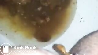 runny shit between legs 2